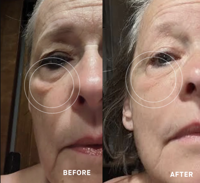 Sharing my full OneSkin review, before/after thoughts, and my exclusive discount code CHELSEE15 for 15% off your first order!